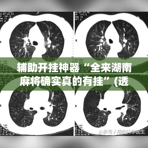 辅助开挂神器“全来湖南麻将确实真的有挂	”(透视挂)辅助透视教程